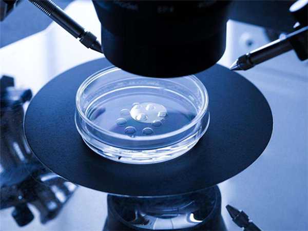 试管婴儿胚胎移植失败，有没有必要做种植窗检测？